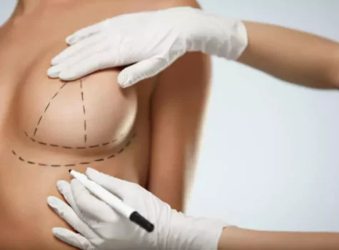 Der neuste Trend in der Brustchirurgie: Hybrid-Brustvergrößerung in München