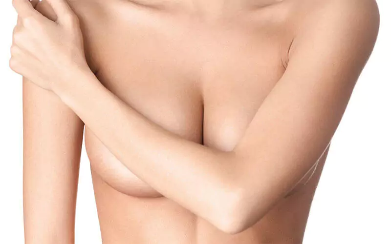 brustvergroesserung-muenchen-asymmetrie-brust