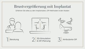 Ablauf einer Brustvergrößerung in München mit den Schritten Beratung, 3D-Simulation, OP-Planung und ambulante OP