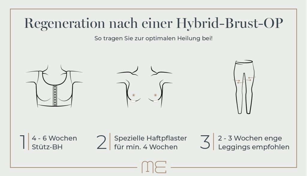 Hybrid Brustvergrößerung mit Implantat und Eigenfett
