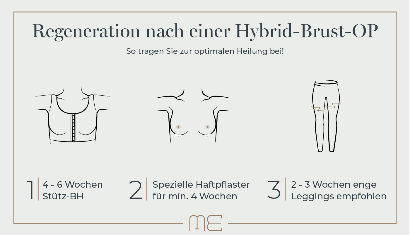 Grafik zur Regeneration nach der Hybrid-Brustvergrößerung