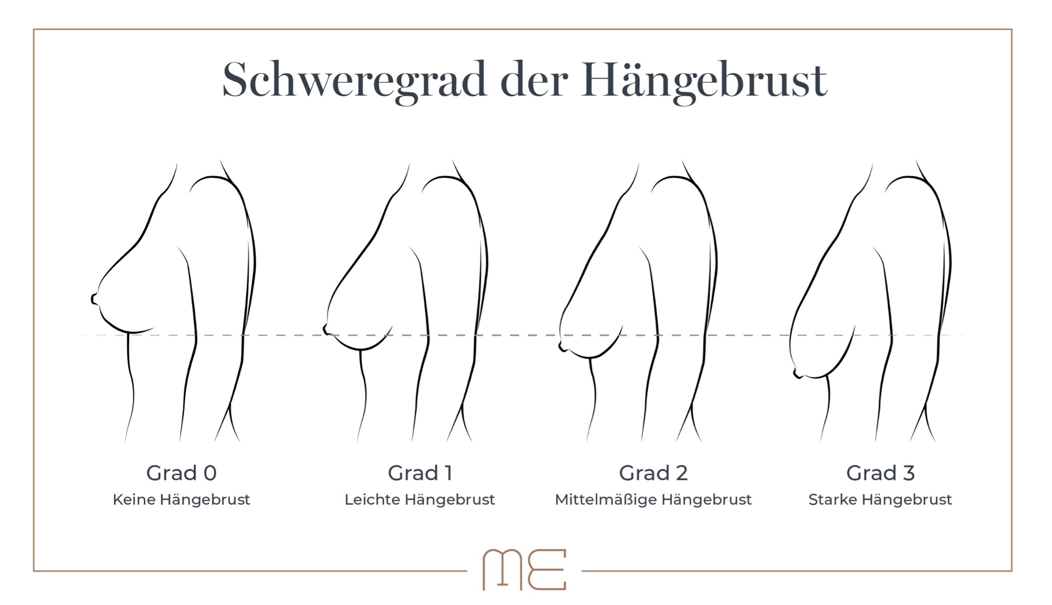 kleine schlaffe titten Unrimmed bh für frauen, kleine titten, huddled und ...