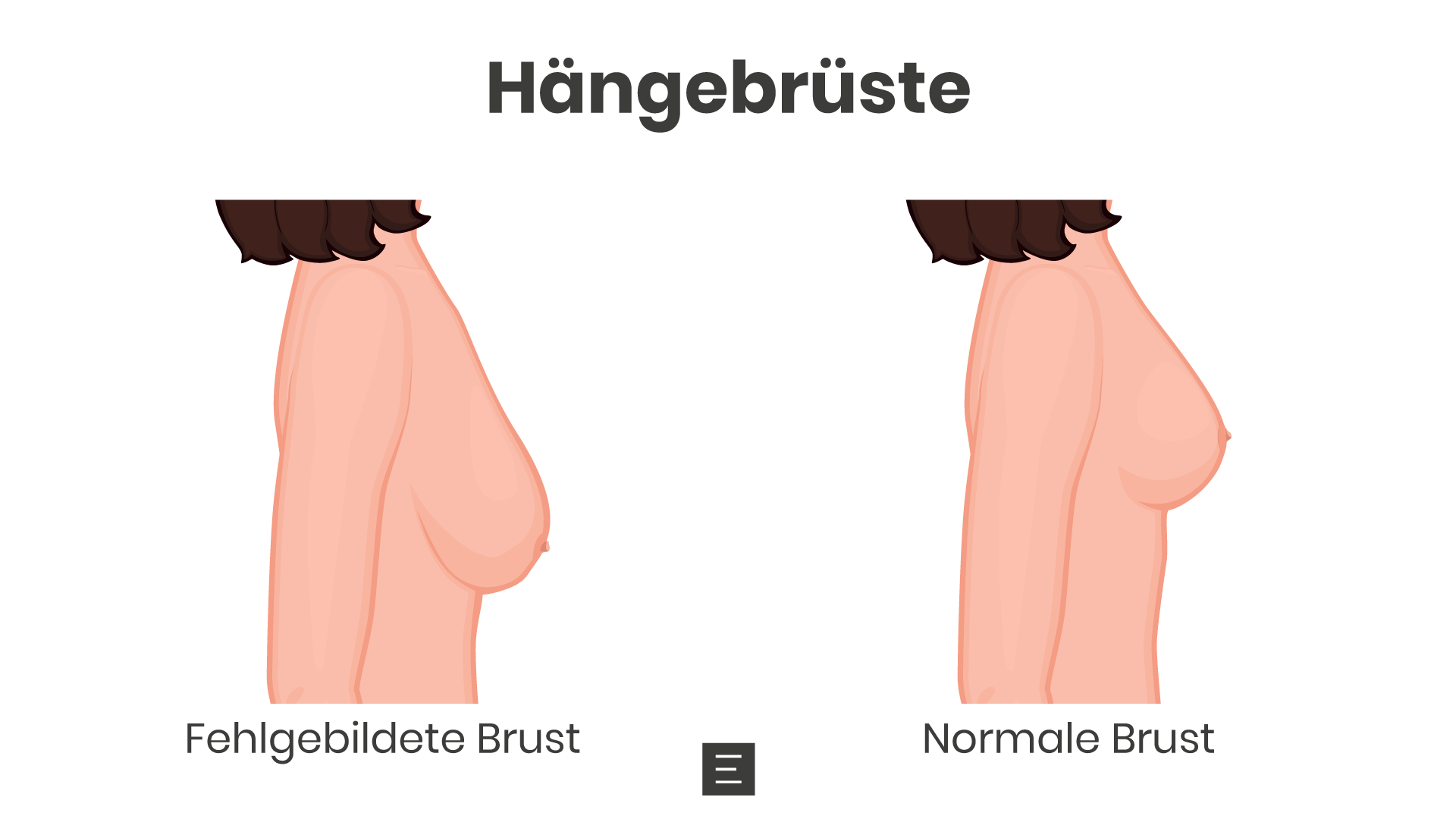 haengebrueste-pd-dr-med-maximilian-eder