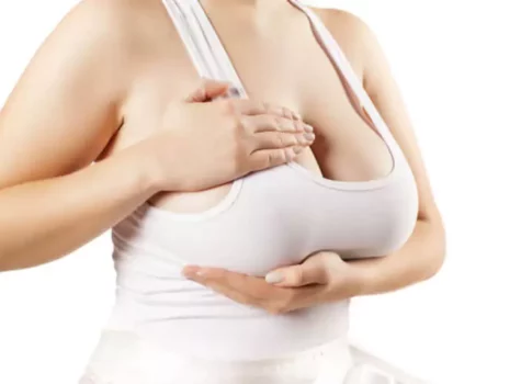 Makromastie: Ursachen, Symptome & Behandlung zu großer Brüste