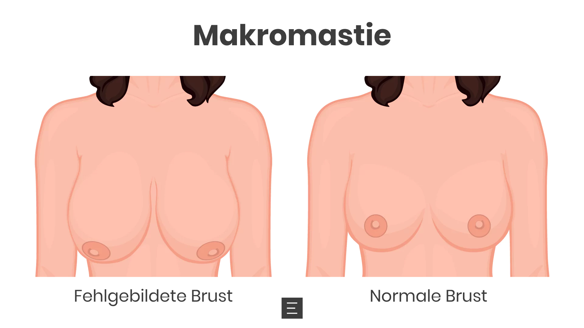 makromastie-pd-dr-med-maximilian-eder