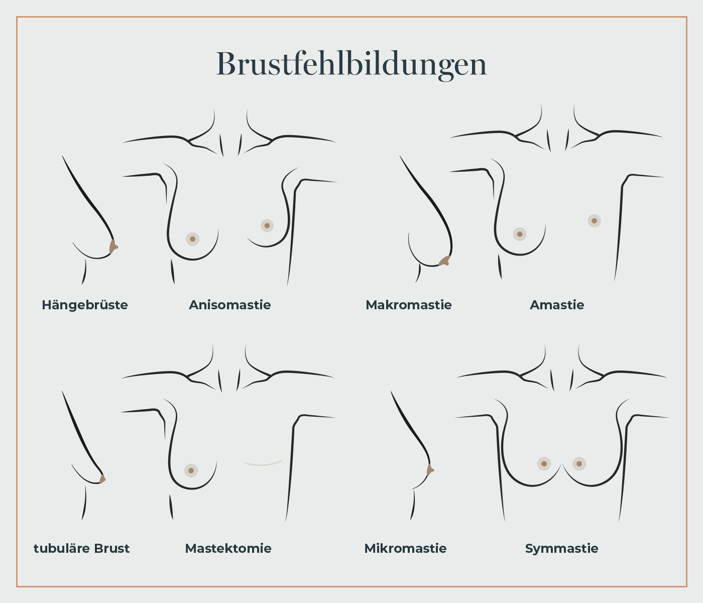 brustfehlbildungen-dr-med-maximilian-eder-muenchen