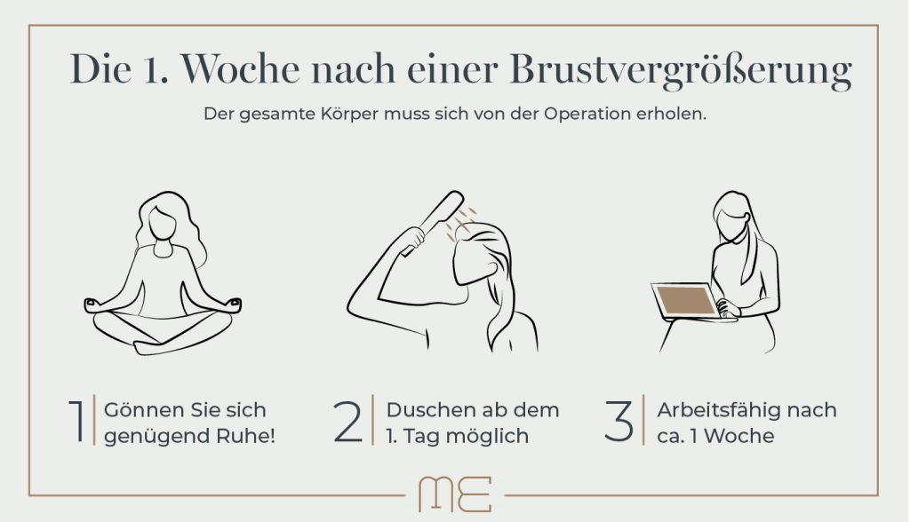 1 Woche nach Brustvergrößerung: So tragen Sie zur Heilung bei