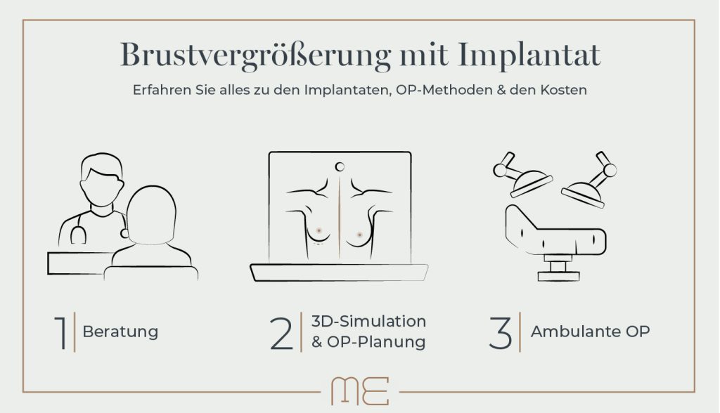 Brustvergrößerung München mit Implantat