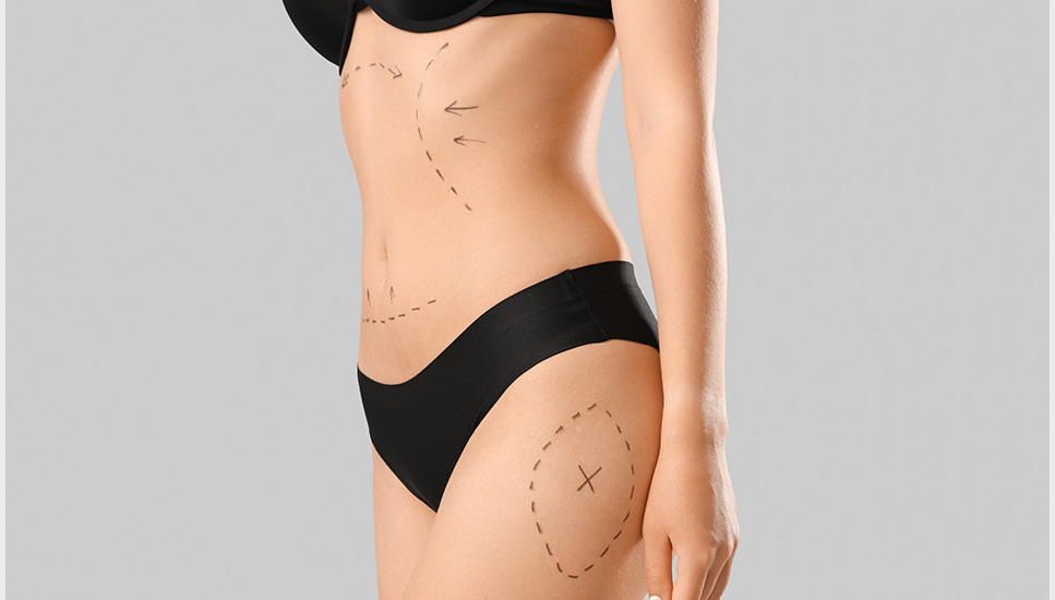 Plastische Ästhetische Chirurgie in München