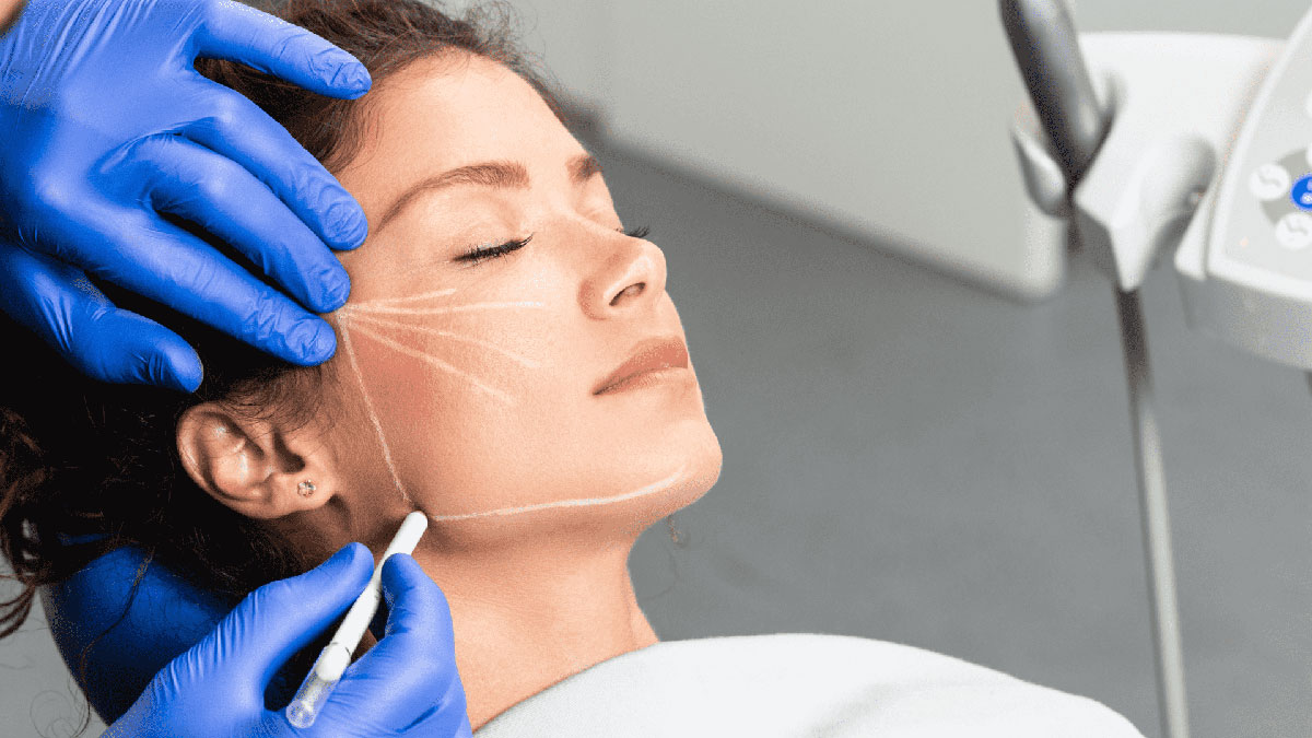 Lipofilling Hautverjüngung in München